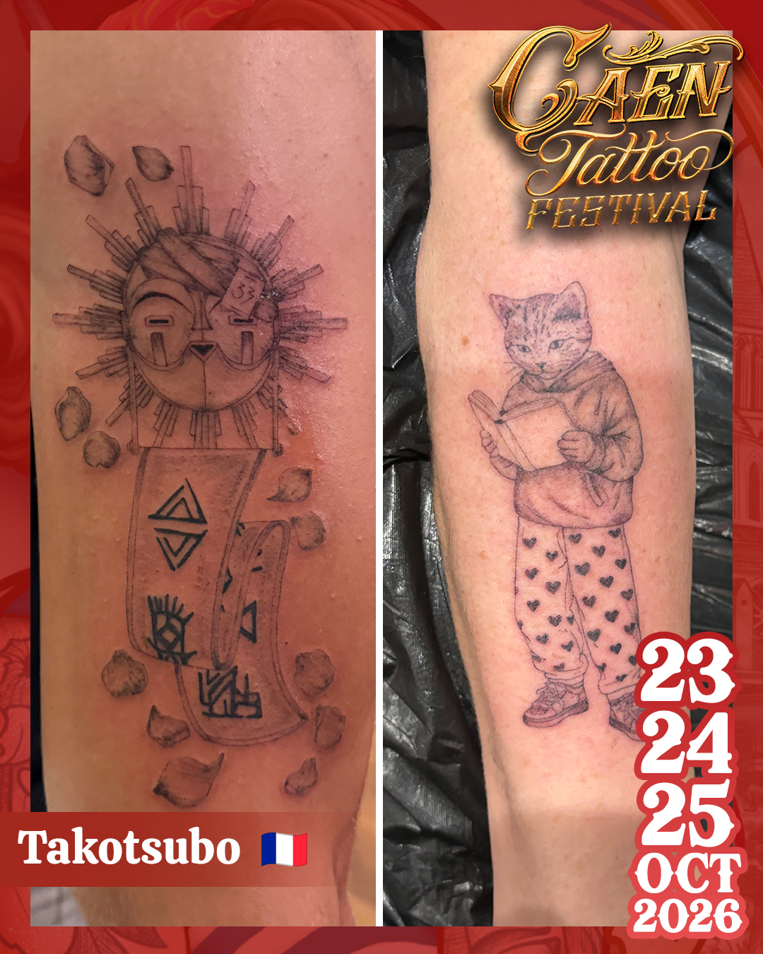 Takotsubo2